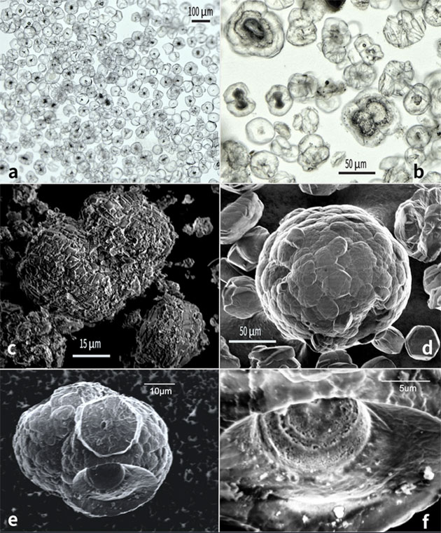 Das in den Kernproben gelöste Material beinhaltet Mineralaggregate auf nahezu reinem Dolormit (a). Schon im Lichtmikroskop zeigen sich in einigen dieser Aggregate dunkle Einschüsse (b). Die sich bei weiteren Analysen als die beschriebenen Mikrohabitate erwiesen (u.a.c-f). Copyright/Quelle: Snyder et al. (Natur Scientific Report 2019) / University of Abderdeen