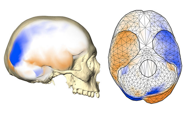 Das gemeinsame Asymmetriemuster des Gehirns wird an einem menschlichen Endocast (Abguss des inneren knöchernen Gehirnschädels) von der Seite (links) und von unten (rechts) gezeigt. Dieses Muster umfasst eine stärker nach hinten ragende linke Gehirnhälfte und eine stärker nach vorne ragende rechte Gehirnhälfte mit lokalisierten größeren Oberflächenbereichen (orange) auf einer Gehirnhälfte im Vergleich zu entsprechenden kleineren Bereichen (blau) auf der anderen Hemisphäre. Es beinhaltet auch unterschiedliche Projektionen der Kleinhirnhälften und der Schläfenlappenpole. Copyright: Simon Neubauer, CC BY-NC-ND 4.0