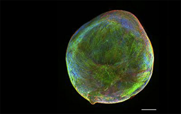 Ein Exemplar eines “Bioengineered Neuronal Organoids” (BENOs); die Ausbildung der neuronalen Netzwerkstruktur wird durch Färbung von neuronalen Markerproteinen (Microtubule-associated protein 2; blau) und Neurofilament (grün) sowie Gliazellen (Glial fibrillary acidic protein; rot) dargestellt. Maßstab (siehe Balken): 0,5 mm. Copyright/Quelle: Zafeiriou et al. (2020). Nat Commun, 11, 3791.