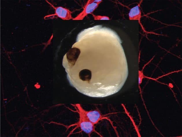 Deutlich sichtbar: Jay Gopalakrishnan und Team gelang es, augenähnliche Strukturen auf einem 2 - 2,5 mm großen Hirn-Organoid aus Stammzellen zu erzeugen. Copyright: J. Gopalakrishnan