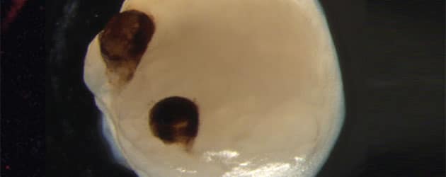 Vergrößerte Ansicht des Hirn-Organoid mit Sehnäpfen. Copyright: J. Gopalakrishnan