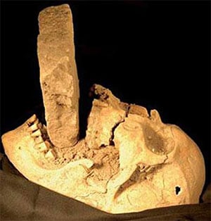 Diesem angeblichen Pest-Vampir in Venedig wurde bei der Bestattung anno 1578 ein Steinquader in den Mund getrieben. Copyright: Matteo Borrini, restiumani.it