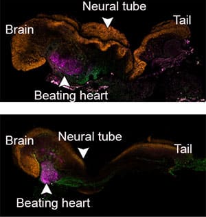 Tag 8 im ‘Leben” eines natürlichen Mäuseembryos (unten) und eines synthetischen Modells (oben). Der synthetische Embryo gleich seinem natürlichen Vorbild um bis zu 95 Prozent. Copyright/Quelle: J. Hanna et all., 2022 / Weizmann Institute of Science