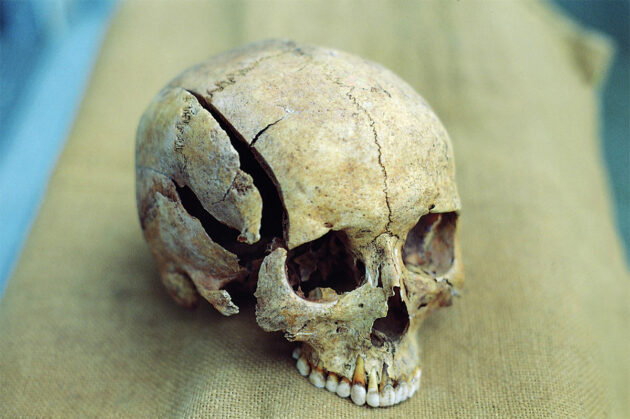 Beleg für eine gewaltsame Einwirkung: Ein gespaltener Schädel. Copyright: Joachim Wahl/ Universität Tübingen