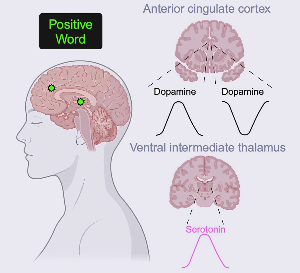 Emotionale Worte lösen regionen- und valenzspezifische Muster der gleichzeitigen Neuromodulatorfreisetzung im menschlichen Thalamus und Kortex aus (Schaubild).Copyright/Quelle: Batten et al., Cell Reports 2025