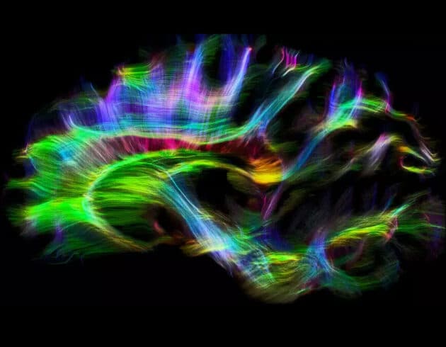 Nervenfasern im Gehirn eines Schimpansen Copyright: MPI CBS