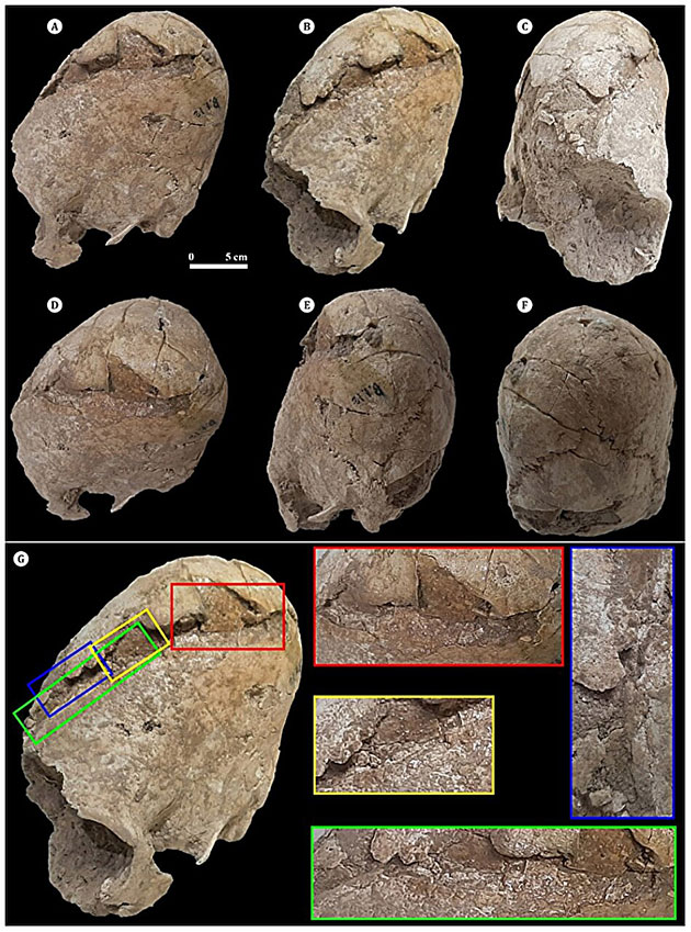 Die Fraktur von BG1.12 in verschiedenen Ansichten (A–F). Der Schädelbruch dieses Exemplars beginnt im vorderen Bereich des Stirnbeins und verläuft schräg bis zur sagittalen Begrenzung des linken Scheitelbeins (G).Copyright/Quelle: Alirezazadeh u. Nasab, International Journal of Osteoarchaeology (2025)