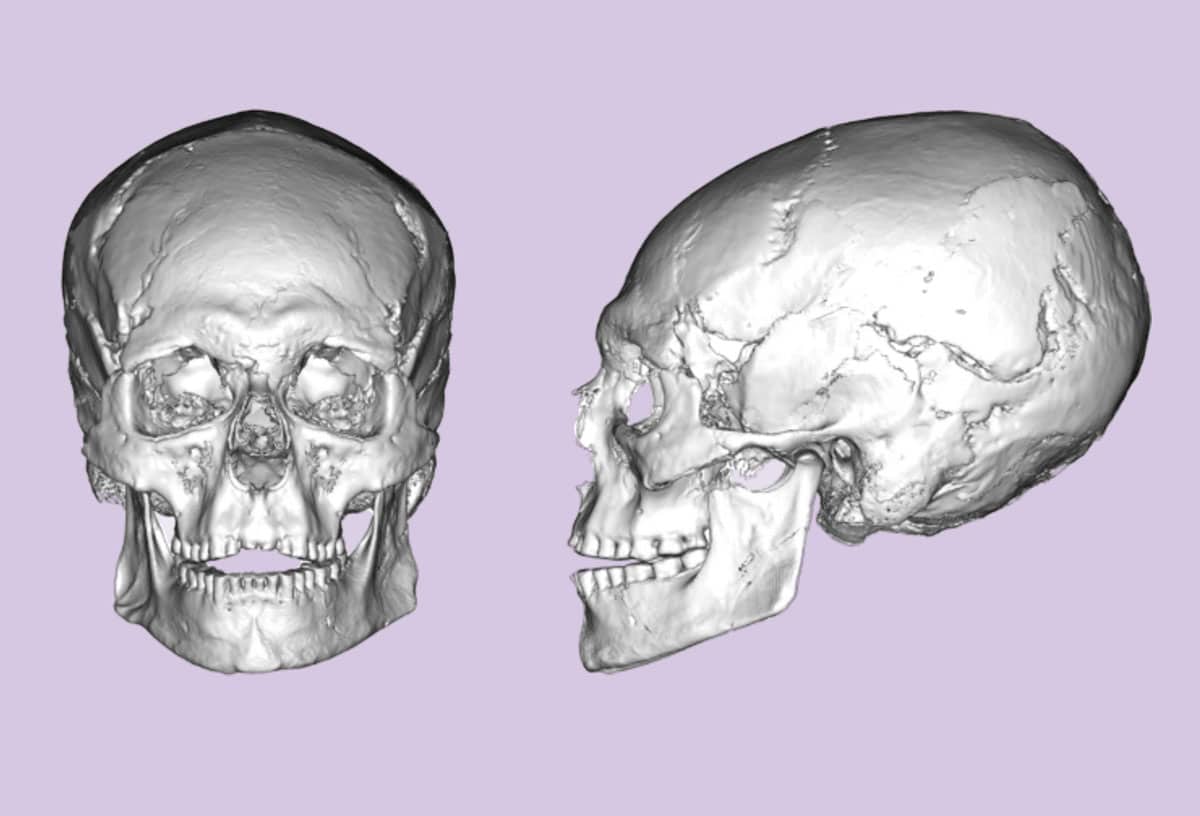 Der aus den Funden digital rekonstruierte Schädel des Individuums „AC12“Copyright/Quelle: T. Mori et al., Scientific Reports 2025