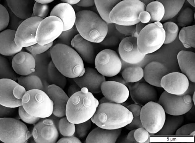 Symbolbild: Backhefe unter dem Elektronoenmikroskop. Copyright: Mogana Das Murtey and Patchamuthu Ramasamy (via WikimediaCommons) / CC BY-SA 3.0