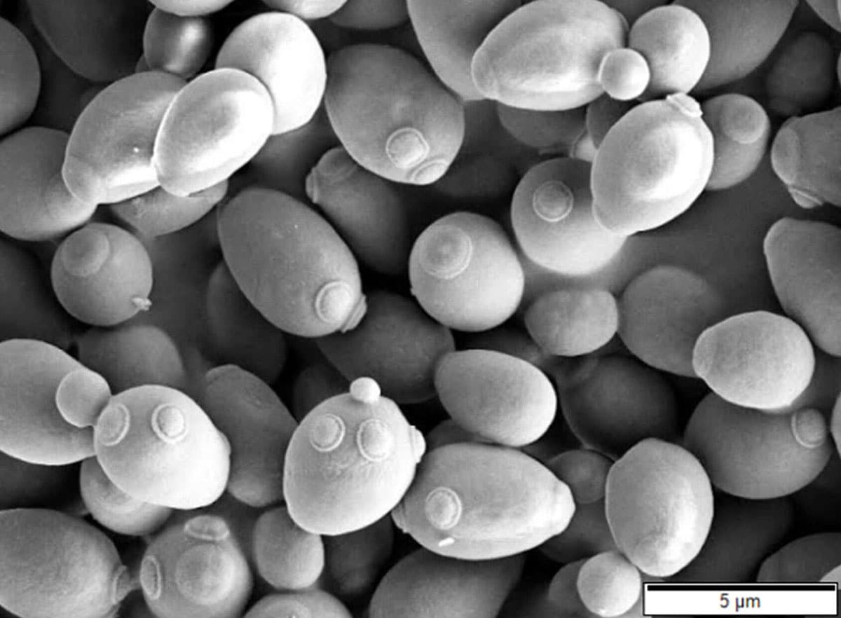 Symbolbild: Backhefe unter dem Elektronoenmikroskop.Copyright: Mogana Das Murtey and Patchamuthu Ramasamy (via WikimediaCommons) / CC BY-SA 3.0