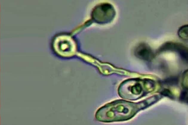 Symbolbild: Mikroskopaufnahme der acidolphilen Pilzart Acidiella bohemica. Copyright: Shu-nigh Oh et al., Frontiers in Microbiology 2026 / CC BY-SA 4.0