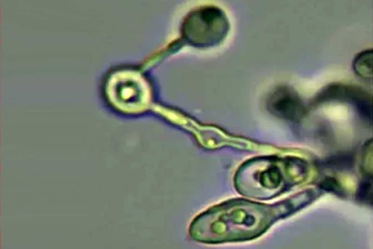 Symbolbild: Mikroskopaufnahme der acidolphilen Pilzart Acidiella bohemica.Copyright: Shu-nigh Oh et al., Frontiers in Microbiology 2026 / CC BY-SA 4.0